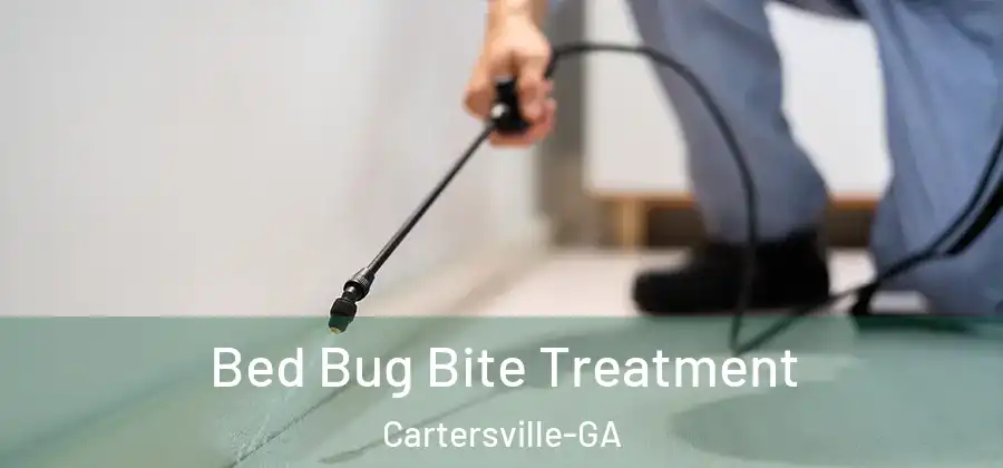 Bed Bug Bite Treatment Cartersville-GA